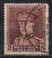 [King Albert, Tipo DX3]