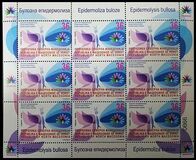 [Children's Disease Awareness - Epidermolysis bullosa, type CHX]