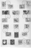 [Flora and Fauna, type NG]